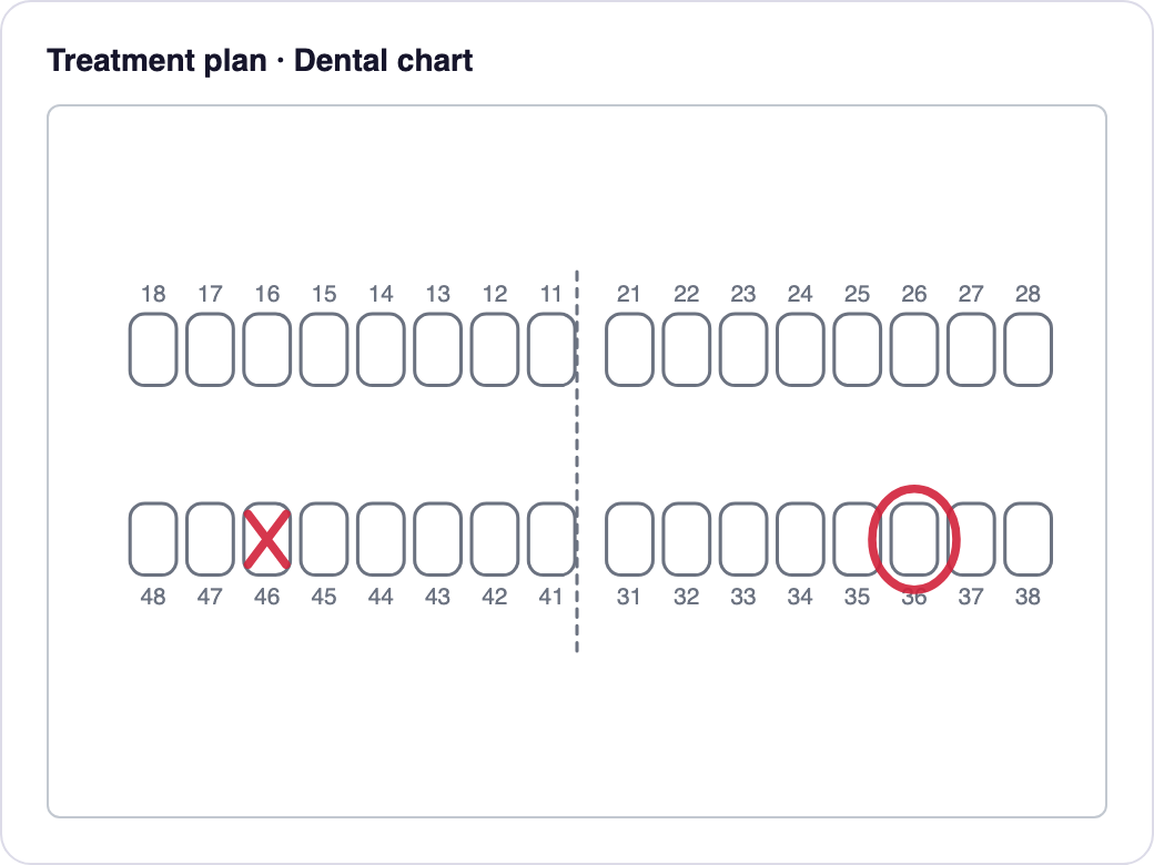 Treatment plan with a dental chart
