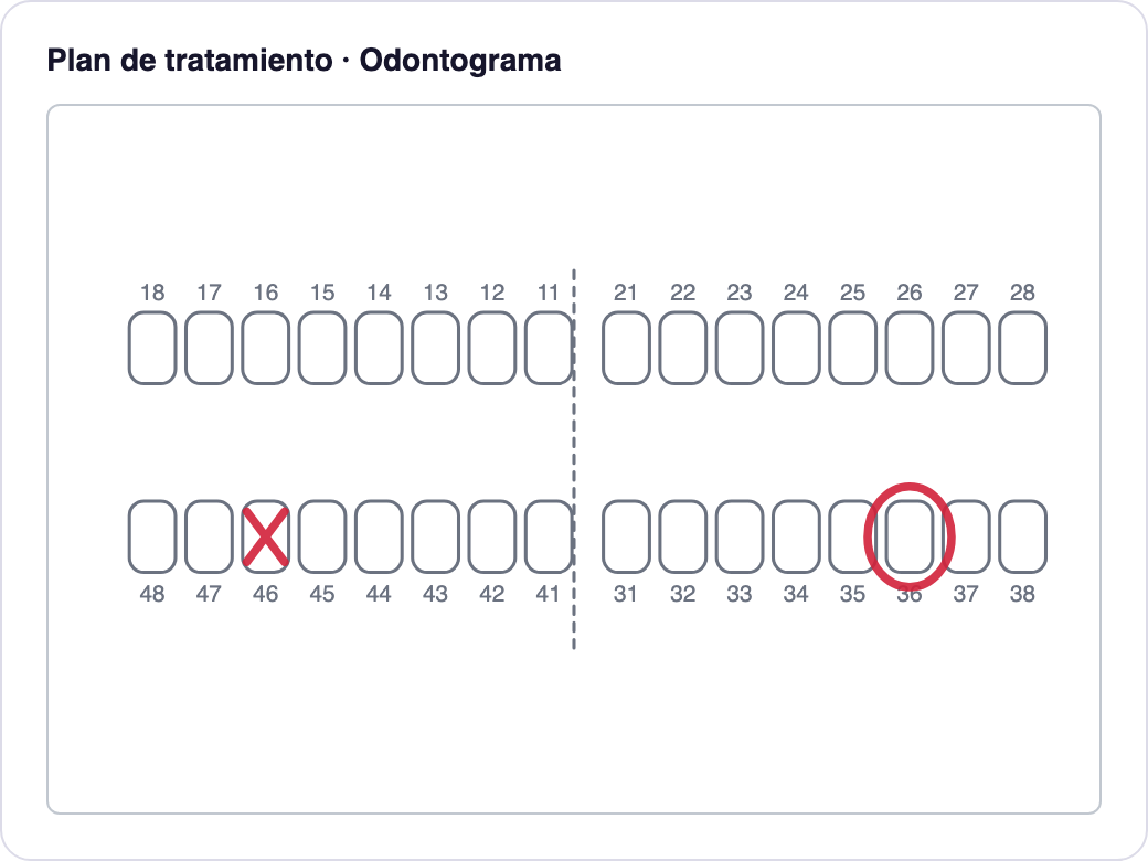 Plan de tratamiento con odontograma